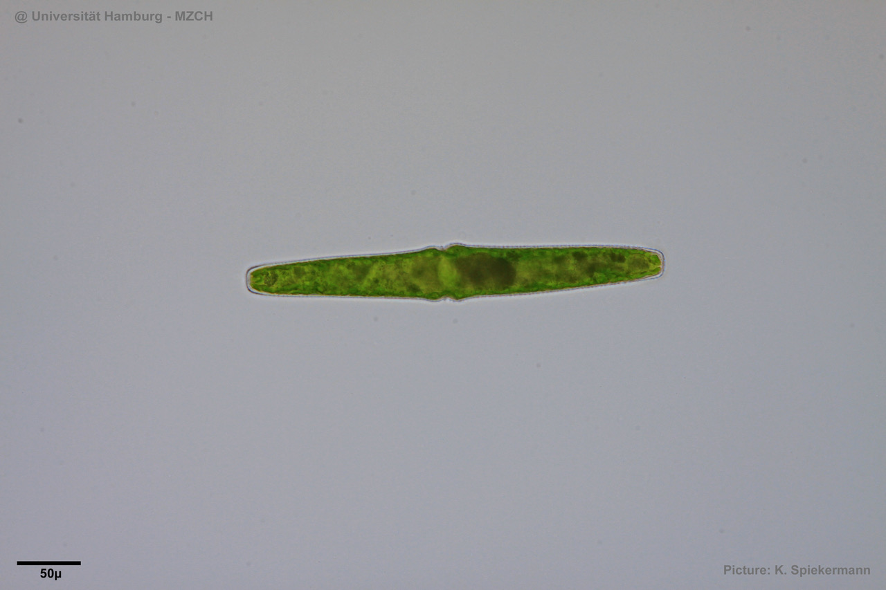 36_Pleurotaenium trabecula2_KKS.jpeg